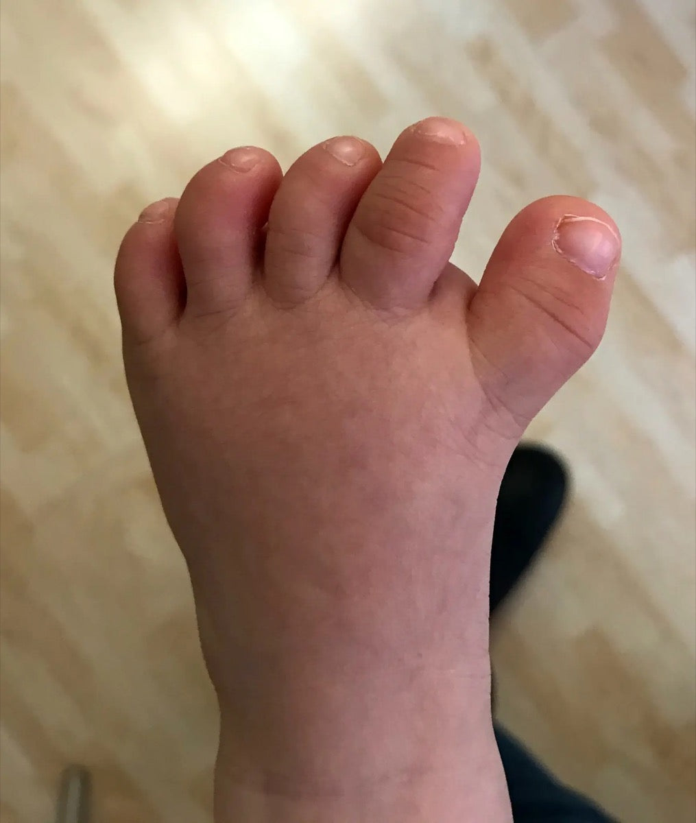 Il piede di un bambino
